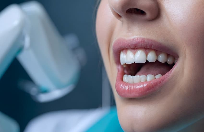 Dental Implant Placement in Cicero, NY - Cicero Dental Associates