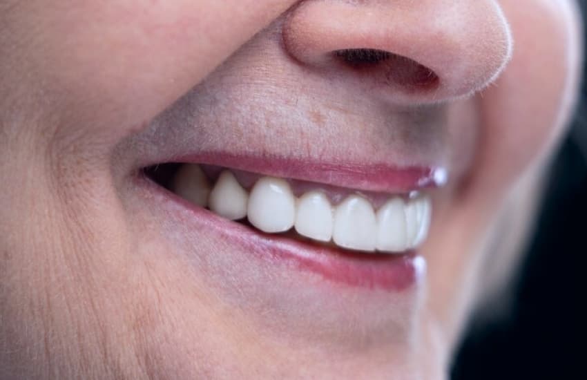 Oral Surgeon in Cicero, NY - Cicero Dental Associates