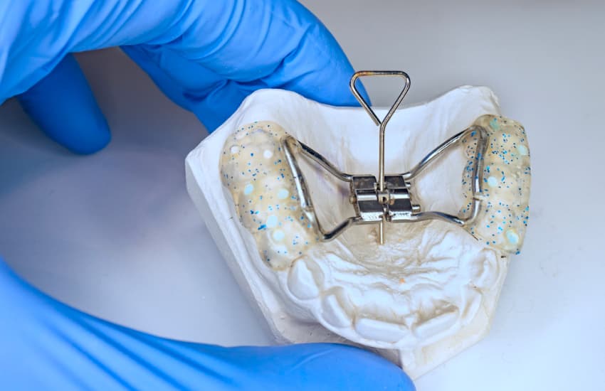 Palatal Expanders in Cicero, NY - Cicero Dental Associates